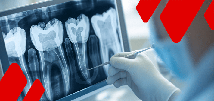 Rectangle